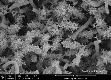 Saccharopolyspora spinosa electron microscope image