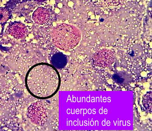 Presencia de cuerpos de inclusin de nucleopoliedrovirus en una frotis de tejidos larvarios